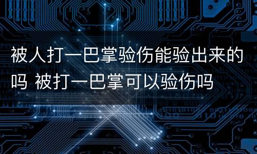 被人打一巴掌验伤能验出来的吗 被打一巴掌可以验伤吗