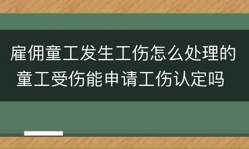 雇佣童工发生工伤怎么处理的 童工受伤能申请工伤认定吗